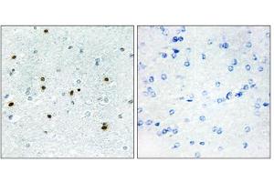 Immunohistochemistry analysis of paraffin-embedded human brain tissue, using DCLK3 antibody. (DCLK3 抗体  (Internal Region))