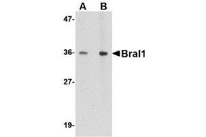 Western blot analysis of BRAL1 in human brain tissue lysate with BRAL1 antibody at (A) 1 and (B) 2 μg/ml. (HAPLN2 抗体  (Center))