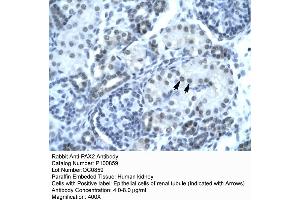Rabbit Anti-PAX2 Antibody  p100859 Paraffin Embedded Tissue: Human Kidney Cellular Data: Epithelial cells of renal tubule Antibody Concentration: 4. (PAX2A 抗体  (Middle Region))
