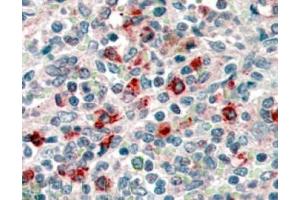 Image no. 1 for anti-CD14 (CD14) (Internal Region) antibody (ABIN374645) (CD14 抗体  (Internal Region))