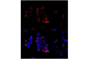 Immunofluorescence (IF) image for anti-ATP-Binding Cassette, Sub-Family G (WHITE), Member 8 (ABCG8) (AA 1-320) antibody (ABIN6219013) (ABCG8 抗体  (AA 1-320))