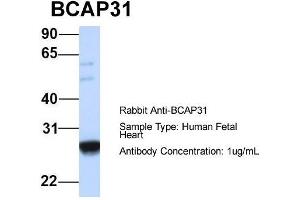 Host:  Rabbit  Target Name:  BCAP31  Sample Type:  Human Fetal Heart  Antibody Dilution:  1. (BCAP31 抗体  (Middle Region))