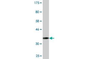 Western Blot detection against Immunogen (37. (Syndetin/VPS50 抗体  (AA 862-964))