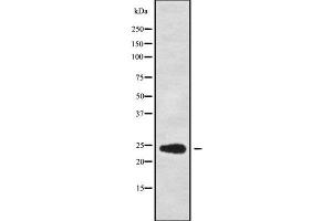 Western blot analysis of RPL13A using COS7 whole cell lysates (RPL13A 抗体)