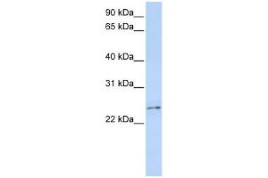 WB Suggested Anti-RCAN3 Antibody Titration:  0. (RCAN3 抗体  (Middle Region))