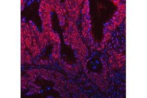 IF analysis of SNRNP200 using anti-SNRNP200 antibody (ABIN7602032). (SNRNP200 抗体  (AA 557-2129))