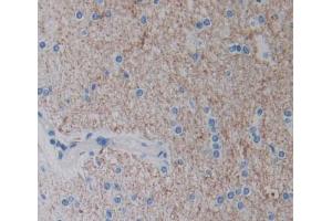 IHC-P analysis of brain tissue, with DAB staining. (EPH Receptor A4 抗体  (AA 621-882))