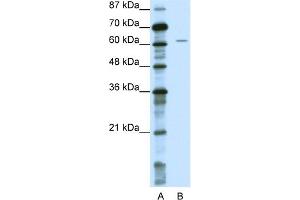 WB Suggested Anti-NOTCH4 Antibody Titration:  0. (NOTCH4 抗体  (Middle Region))