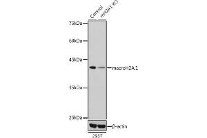 Western blot analysis of extracts from normal (control) and macroH2A. (H2AFY 抗体  (AA 123-372))