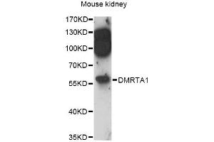 Western blot analysis of extracts of mouse kidney, using DMRTA1 antibody (ABIN6292013) at 1:3000 dilution. (DMRTA1 抗体)