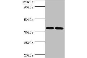 Western blot All lanes: PBK antibody at 6 μg/mL Lane 1: Hela whole cell lysate Lane 2: Mouse gonad tissue Secondary Goat polyclonal to rabbit IgG at 1/10000 dilution Predicted band size: 37, 38 kDa Observed band size: 37 kDa