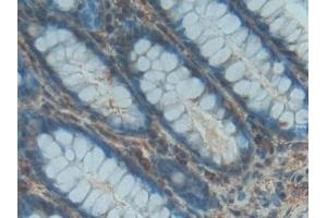 Detection of PDGF BB in Human Rectum Tissue using Polyclonal Antibody to Platelet Derived Growth Factor BB (PDGF BB) (PDGF-BB Homodimer (AA 82-190) 抗体)