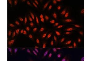 Immunofluorescence analysis of U-2 OS cells using KLHL8 Polyclonal Antibody at dilution of 1:100. (KLHL8 抗体)