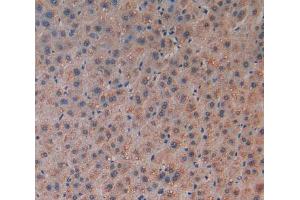 Used in DAB staining on fromalin fixed paraffin-embedded Spleen tissue