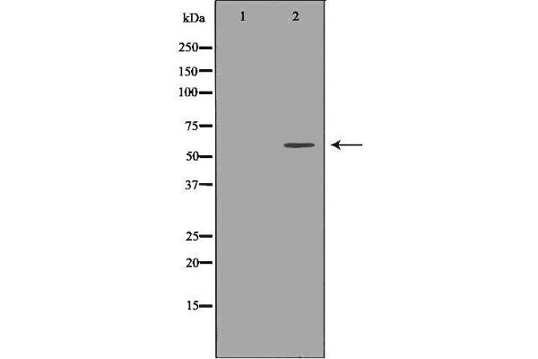 UGT1A9 抗体  (C-Term)