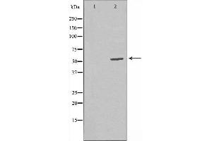 Western blot analysis of extracts from CoLo cells, using RBBP5 antibody. (RBBP5 抗体  (Internal Region))