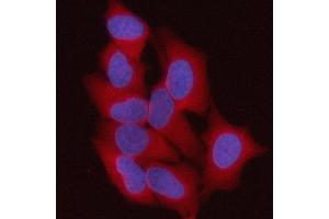 IF analysis of ST13 using anti-ST13 antibody (ABIN7600493).