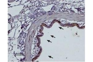 Expression of α2B-Adrenoreceptor in rat lung - Immunohistochemical staining of rat lung paraffin embedded sections using Anti-α2B-Adrenergic Receptor (extracellular) Antibody (ABIN7042900, ABIN7043920 and ABIN7043921), (1:100).