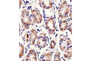 Immunohistochemical analysis of paraffin-embedded H. (PACSIN2 抗体  (C-Term))