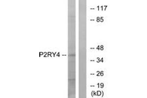 Western blot analysis of extracts from HeLa cells, using P2RY4 Antibody. (P2RY4 抗体  (AA 159-208))