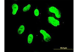 Immunofluorescence of monoclonal antibody to TBX3 on HepG2 cell. (TBX3 抗体  (AA 311-410))