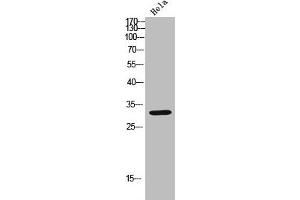Western blot analysis of Hela lysate, antibody was diluted at 2000. (CDK6 抗体  (AA 280-325))