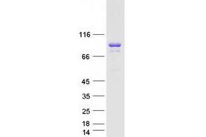 Validation with Western Blot