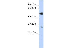 WB Suggested Anti-RNF212 Antibody Titration:  0. (RNF212 抗体  (Middle Region))