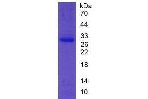 Image no. 1 for Paraoxonase 1 (PON1) (AA 35-206) (Active) protein (His tag) (ABIN6239873) (PON1 Protein (AA 35-206) (His tag))