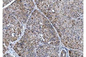 IHC analysis of CSNK2K2 using anti-CSNK2K2 antibody (ABIN7602871).