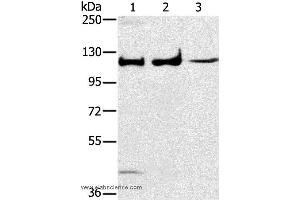 Western blot analysis of Human fetal muscle tissue, A172 and K562 cell, using MAPK7 Polyclonal Antibody at dilution of 1:250 (MAPK7 抗体)