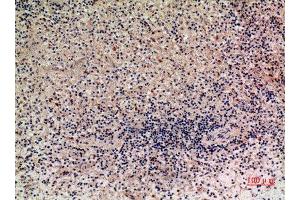 Immunohistochemistry (IHC) analysis of paraffin-embedded Human Liver, antibody was diluted at 1:100. (XCL1 抗体  (Internal Region))