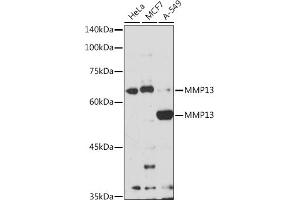 Western blot analysis of extracts of various cell lines, using MMP13 antibody (ABIN7268418) at 1:1000 dilution.