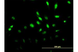 Immunofluorescence of monoclonal antibody to MAPK6 on HeLa cell. (MAPK6 抗体  (AA 612-721))