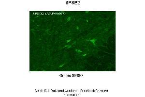Sample Type : Rhesus macaque spinal cord Primary Antibody Dilution : 1:300 Secondary Antibody : Donkey anti Rabbit 488 Secondary Antibody Dilution : 1:500 Color/Signal Descriptions : Green: SPSB2 Gene Name : SPSB2 Submitted by : Timur Mavlyutov, Ph. (SPSB2 抗体  (N-Term))