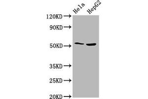 Western Blot Positive WB detected in: Hela whole cell lysate, HepG2 whole cell lysate All lanes: THNSL2 antibody at 4. (THNSL2 抗体  (AA 295-441))