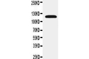 Anti-SLC12A1 antibody, Western blotting WB: Rat Kidney Tissue Lysate (SLC12A1 抗体  (N-Term))