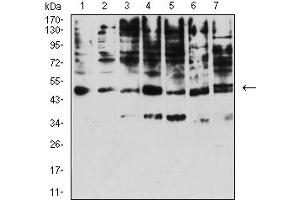 Western blot analysis using KIR3DL1 mouse mAb against A431 (1), Raji (2), SPC-A-1 (3), K562 (4), HEK293 (5), U937 (6), and C6 (7) cell lysate. (KIR3DL1 抗体  (AA 22-340))