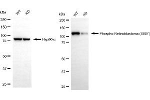 Western blotting analysis using phospho-retinoblastoma (S807) antibody (ABIN7800188). (Recombinant Retinoblastoma Protein (Rb) 抗体  (pSer807))