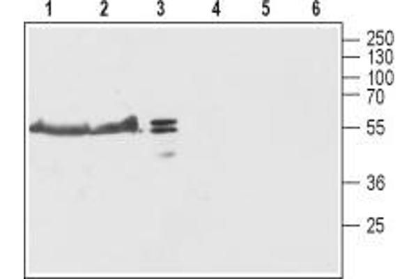 TMEM38B 抗体  (Cytoplasmic Loop, Intracellular)