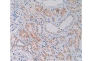 Detection of VNN1 in Human Kidney Tissue using Polyclonal Antibody to Vanin 1 (VNN1) (VNN1 抗体  (AA 36-223))