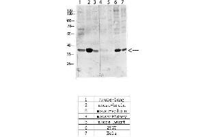 Western Blotting (WB) image for anti-cAMP Responsive Element Binding Protein 1 (CREB1) (pSer133) antibody (ABIN3181974)
