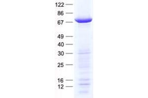 Western Blotting (WB) image for 6-phosphofructo-2-Kinase/fructose-2,6-Biphosphatase 1 (PFKFB1) protein (His tag) (ABIN2728746)