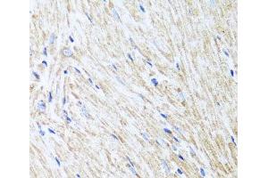 Immunohistochemistry of paraffin-embedded Mouse heart using L2HGDH Polyclonal Antibody at dilution of 1:100 (40x lens). (L2HGDH 抗体)