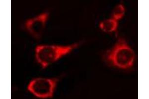 Immunofluorescence (fixed cells) (IF/ICC) image for anti-Activin A Receptor, Type IB (ACVR1B) (Internal Region) antibody (ABIN6257679)