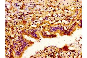 Immunohistochemistry (IHC) image for anti-Sema Domain, Immunoglobulin Domain (Ig), Short Basic Domain, Secreted, (Semaphorin) 3A (SEMA3A) (AA 357-445) antibody (ABIN7168784)