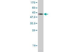 Western Blot detection against Immunogen (36. (CRYGD 抗体  (AA 75-174))