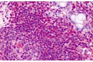 Human Lymphocytes: Formalin-Fixed, Paraffin-Embedded (FFPE) (CCDC50 抗体  (AA 468-481))