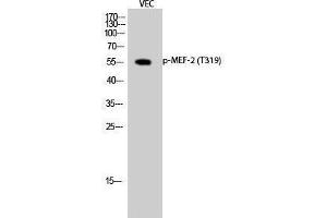 Western Blotting (WB) image for anti-Myelin Expression Factor 2 (MYEF2) (pThr319) antibody (ABIN3172926) (MYEF2 抗体  (pThr319))