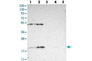 Western blot analysis of Lane 1: RT-4, Lane 2: U-251 MG, Lane 3: Human Plasma, Lane 4: Liver, Lane 5: Tonsil with APOO polyclonal antibody . (APOO 抗体)